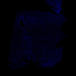 11PCW human midbrain